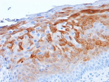 IHC staining of FFPE human cervix with Cytokeratin 1 antibody (clone LHK1). HIER: boil tissue sectio
