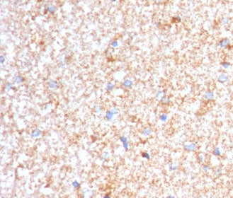 IHC staining of FFPE human brain with Serum Amyloid P antibody (clone SMPC-1). HIER: boil tissue sec
