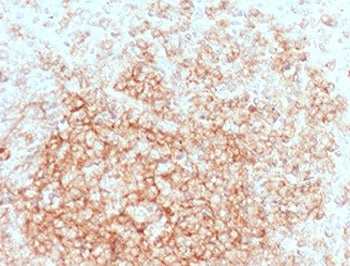 IHC testing of FFPE human tonsil tissue with CD21 antibody (clone CDLA21-1). HIER: boil tissue secti
