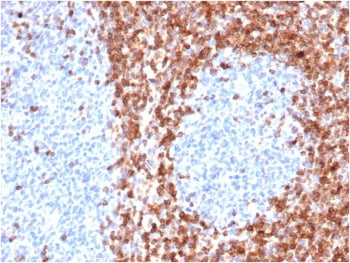 Bcl-2 Antibody