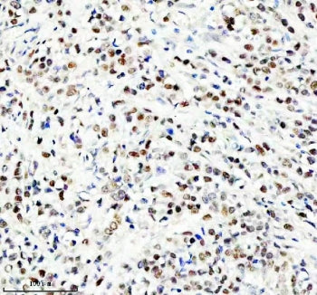 NEDD9 Antibody