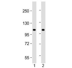 Western blot testing of human 1) lung and 2) HeLa lysate with NAT10 antibody at 1:2000. Predicted mo