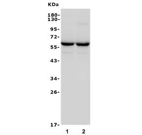 Western blot testing of 1) rat brain and 2) mouse brain lysate with GAD65 antibody. Predicted molecu