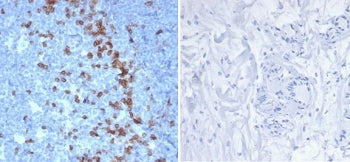 PDCD1 Antibody / PD-1 / PD1