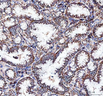 Integrin alpha 3 Antibody / ITGA3