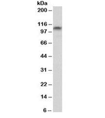 Western blot testing of rat brain lysate with PSD95 antibody at 0.3ug/ml. Molecular weight: routinel