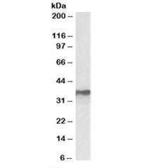 Western blot testing of MCF7 lysate with HNRNPA2B1 antibody at 0.3ug/ml. Predicted molecular weight: