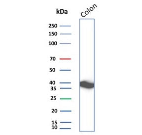 Western blot testing of human colon tissue lysate with CNN1 antibody. Predicted molecular weight ~34