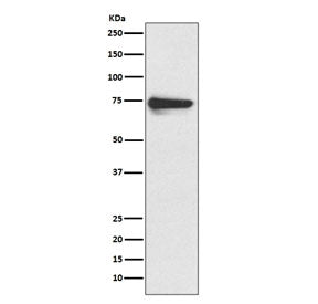 Tyrosinase Antibody / TYR