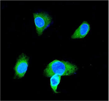 GSTP1 Antibody