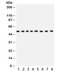 Western blot testing of 1) rat liver, 2) human placenta, 3) rat spleen, 4) rat pancreas, 5) human He
