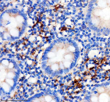 IHC staining of FFPE human appendix tissue with Factor XIIIa antibody, HRP-secondary and DAB substra