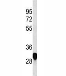 PLP antibody western blot analysis in HeLa lysate. Predicted molecular weight ~30/26 kDa (isoforms 1