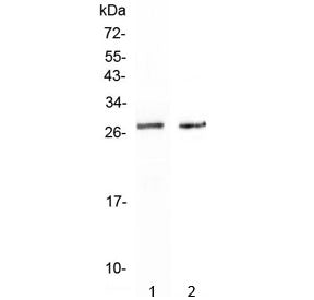 Western blot testing of 1) human HepG2 and 2) mouse HEPA1-6 cell lysate with SPR antibody at 0.5ug/m