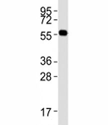 Western blot testing of PRMT3 antibody at 1:2000 dilution + mouse brain lysate; Predicted molecular 