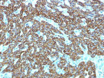 IHC testing of FFPE human skin with recombinant Basic Cytokeratin antibody (clone KRTH/1576R). Requi