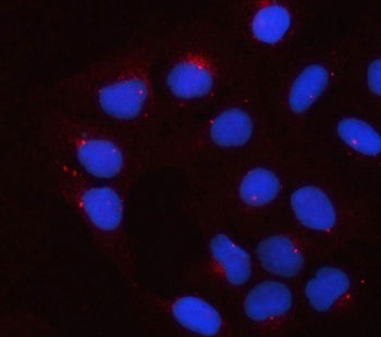 Immunofluorescent staining of FFPE human U-2 OS cells with Apolipoprotein E antibody (red) and DAPI 