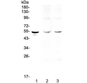 Western blot testing of 1) human SGC-7901, 2) rat heart and 3) mouse heart lysate with TPH1 antibody