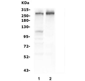 Western blot testing of human 1) HEK293 and 2) PC-3 cell lysate with Tuberin antibody. Expected mole