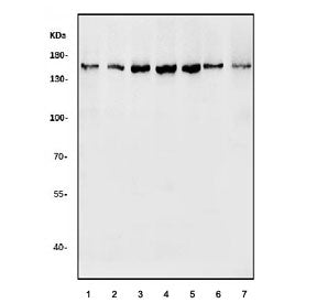 Western blot testing of human 1) HepG2, 2) HeLa, 3) MCF7, 4) HEK293, 5) A549, 6) rat brain and 7) mo