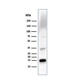 TTR Antibody / Transthyretin / Prealbumin