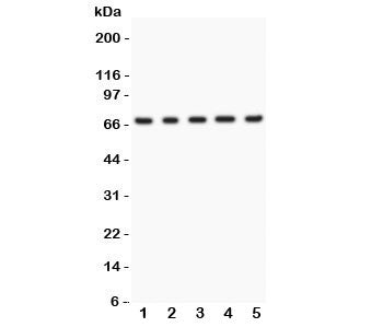 Menin Antibody
