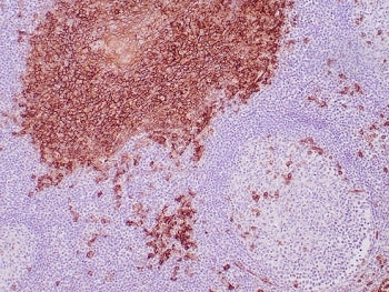 IHC staining of FFPE human tonsil tissue with CD138 antibody (clone SDC1/7177). HIER: boil tissue se