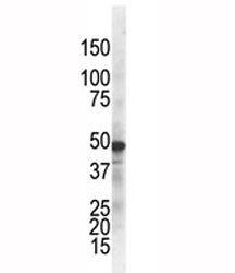 The IKK gamma antibody used in western blot to detect IKKg in ZR75-1 cell lysate. Predicted molecula
