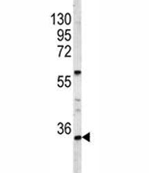 HOXA9 Antibody