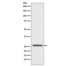 Western blot testing of human SH-SY5Y cell lysate with Claudin 11 antibody. Predicted molecular weig