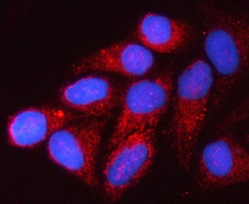 Immunofluorescent staining of FFPE human HeLa cells with VDAC1 antibody (red) and DAPI nuclear stain