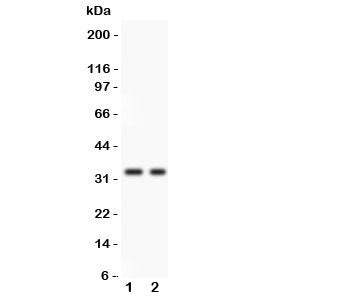 Western blot testing of SFRP2 antibody and 1. COLO320, 2. SW620 lysate. Predicted/observed molecular