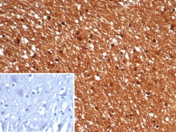 IHC staining of FFPE human brain tissue with GBX2 antibody (clone GBX2/7235). Inset: PBS used in pla