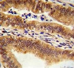 IHC testing of FFPE human uterus tissue with MEAK7 antibody. HIER: steam section in pH6 citrate buff