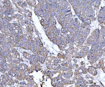 Tollip Antibody