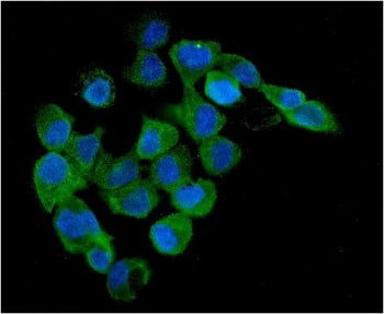 Immunofluorescent staining of FFPE human A431 cells with PRKAB1 antibody (green) and DAPI nuclear st