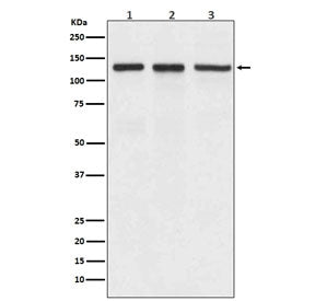 Western blot testing of 1) human A549, 2) mouse spleen and 3) rat brain lyaste with ITGAV antibody. 