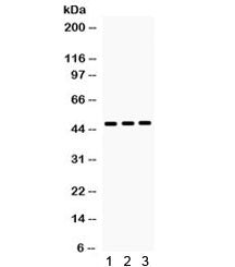 Western blot testing of 1) rat liver, 2) mouse liver and 3) human HepG2 lysate with HHEX antibody. R