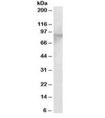 Western blot testing of MOLT4 lysate with EZH1 antibody at 2ug/ml. Predicted molecular weight ~85kDa