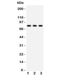 Western blot testing of 1) rat brain, 2) mouse brain and 3) human 293 lysate with APG7 antibody. Pre