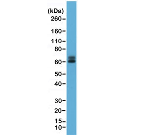 Western blot testing of human HeLa cell lysate with recombinant Paxillin antibody at 1:1000. Predict