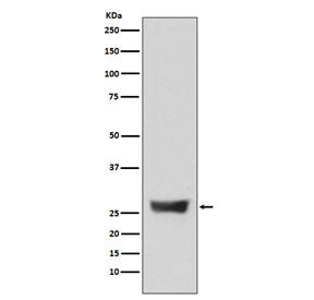 Western blot testing of human 293T cell lysate with NDUFS3 antibody. Predicted molecular weight ~30 