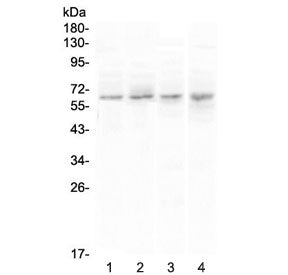 Western blot testing of human 1) PANC-1, 2) U-87 MG, 3) COLO-320 and 4) SGC-7901 cell lysate with CC