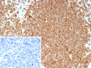 IHC staining of FFPE human tonsil tissue with recombinant CD20 antibody (clone MS4A1/8072R). Inset: 