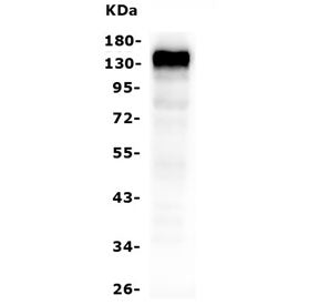 Western blot testing of human Raji cell lysate with CD22 antibody. Expected molecular weight: 76-150