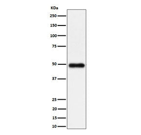 Western blot testing of human K562 cell lysate with NgR3 antibody. Predicted molecular weight ~49 kD