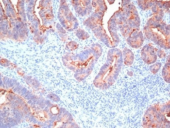 Pan-CEA Antibody Cocktail