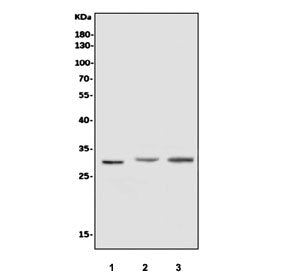 Western blot testing of human 1) U-87 MG, 2) rat kidney and 3) mouse kidney tissue lysate with Super