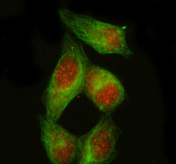 Immunofluorescent staining of PDX1 using anti-PDX1 antibody (red) and anti-Beta Tubulin antibody (gr