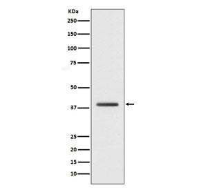 Western blot testing of human HepG2 cell lysate with H2AFY antibody. Predicted molecular weight ~40 